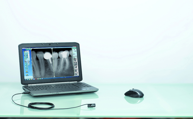سنسور رادیوگرافی تک دندان مدل OPTEO