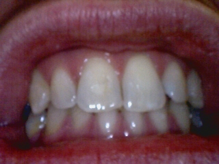 دوربین داخل دهانی