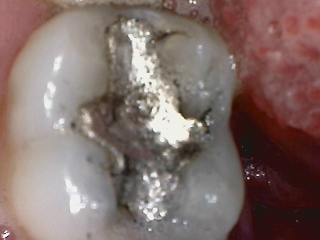 دوربین داخل دهانی