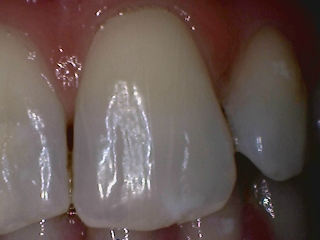 دوربین داخل دهانی